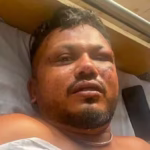 Air India Survivor