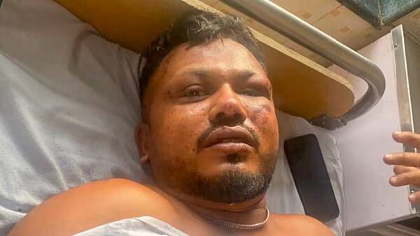Air India Survivor
